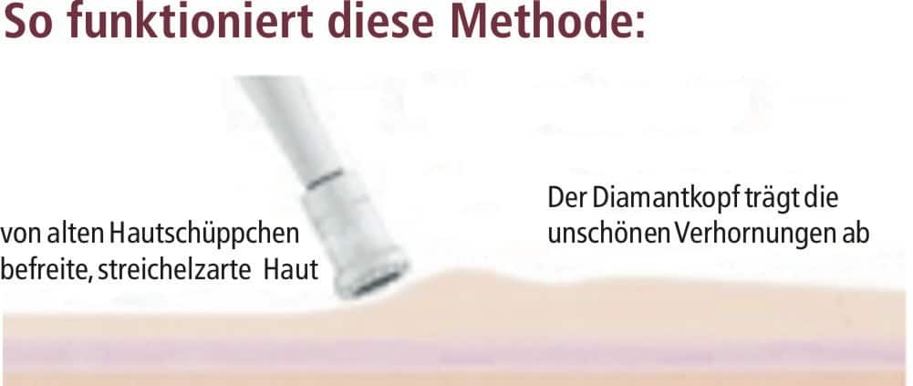 Kosmetikbehandlung Haut Problemhaut in dem Kosmetikstudio Kosmegi in Mainz